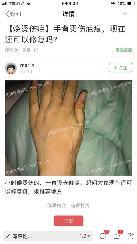 中國疤痕論壇