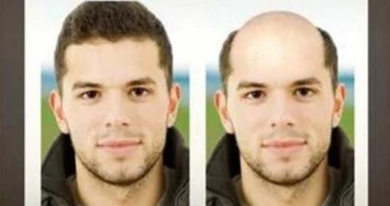 禿頭生成器最新版BaldBooth