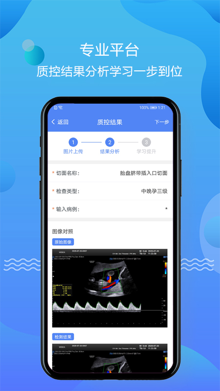 智庫超聲應用