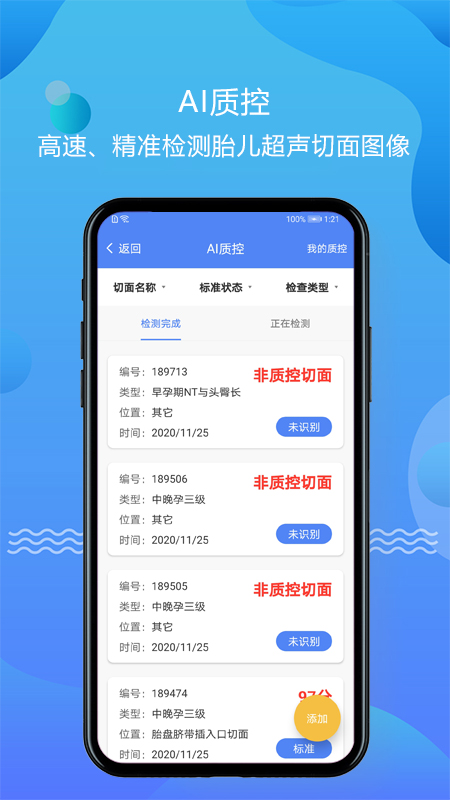 智庫超聲應用