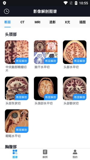 影像解剖圖譜App官方版