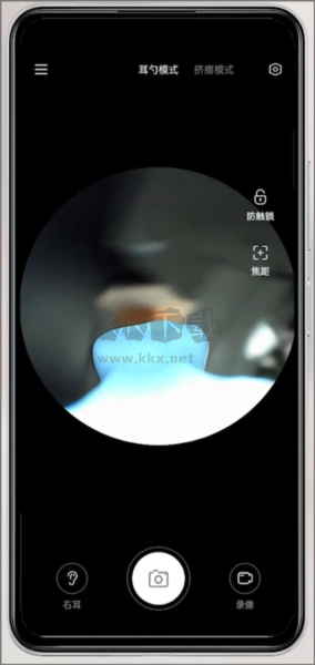 Xlife掏耳勺應(yīng)用程序 v1.0.45