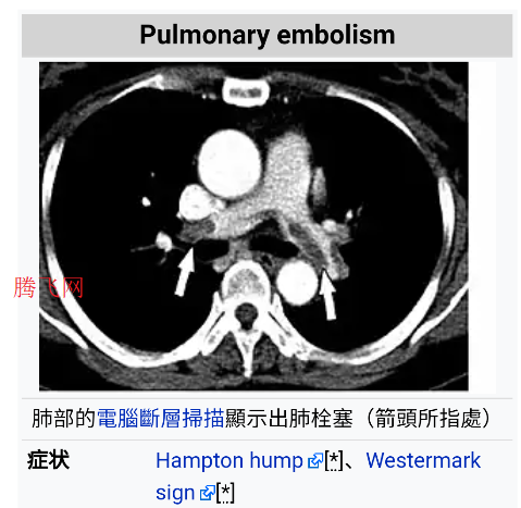 醫(yī)學(xué)維基百科離線版app