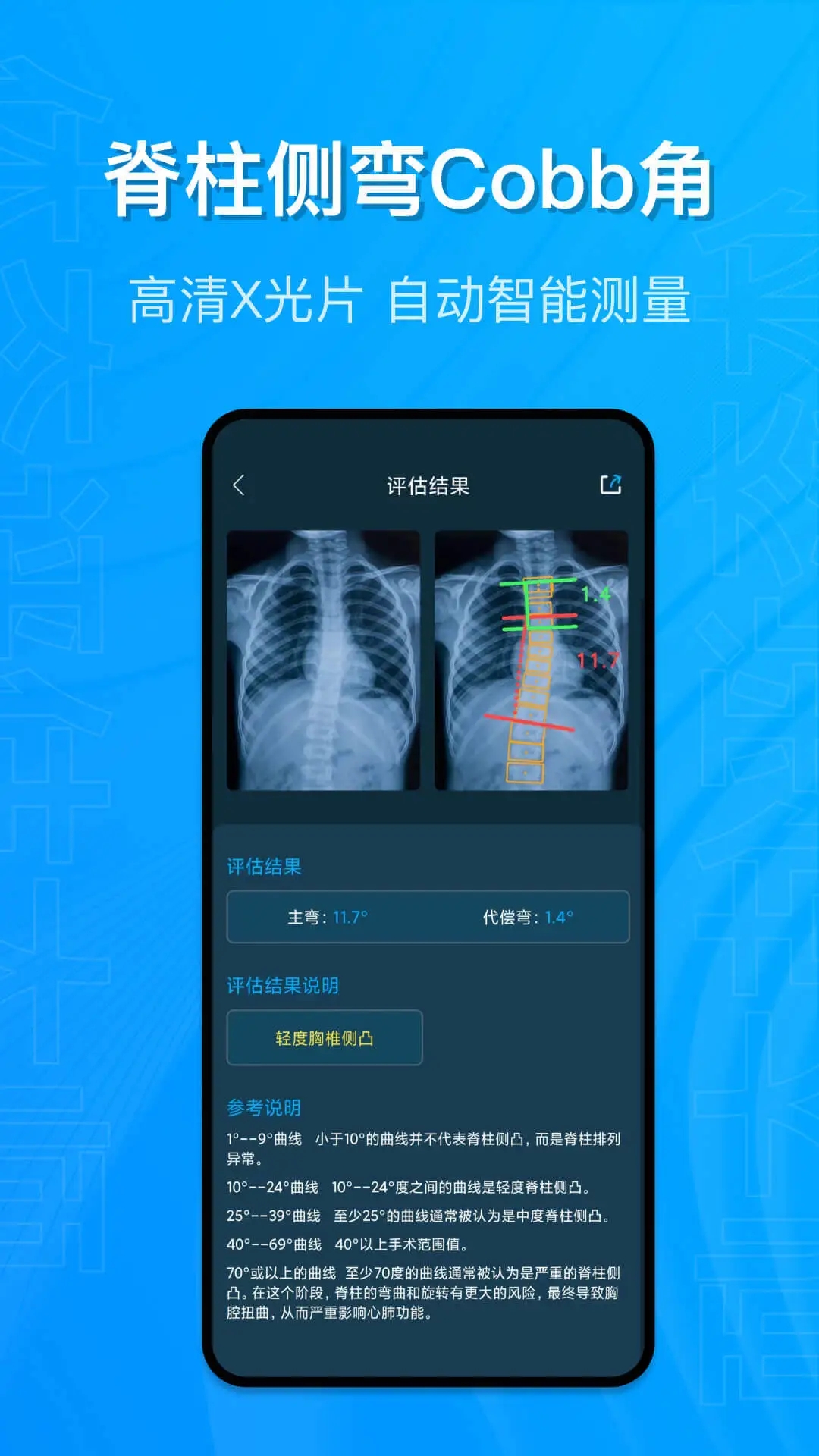 體態(tài)評估大師App更新