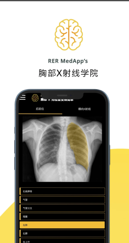 胸部X射線手機(jī)版應(yīng)用