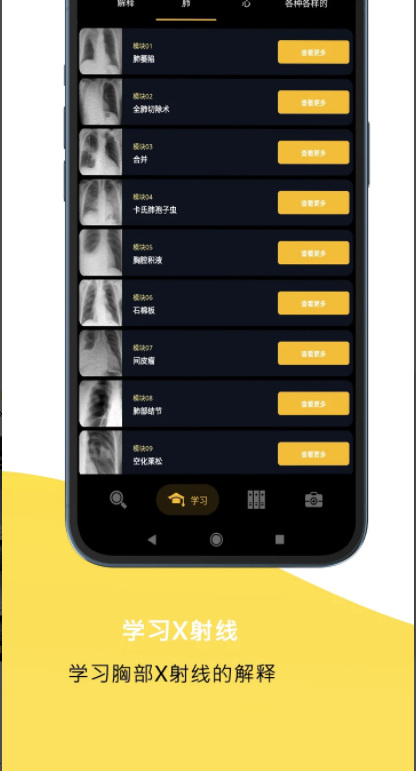 胸部X射線手機(jī)版應(yīng)用