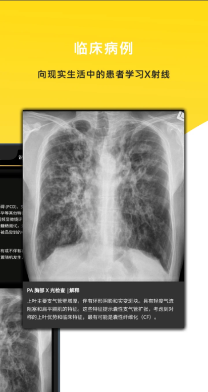 胸部X射線手機(jī)版應(yīng)用