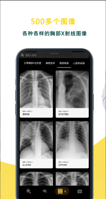 胸部X射線手機(jī)版應(yīng)用