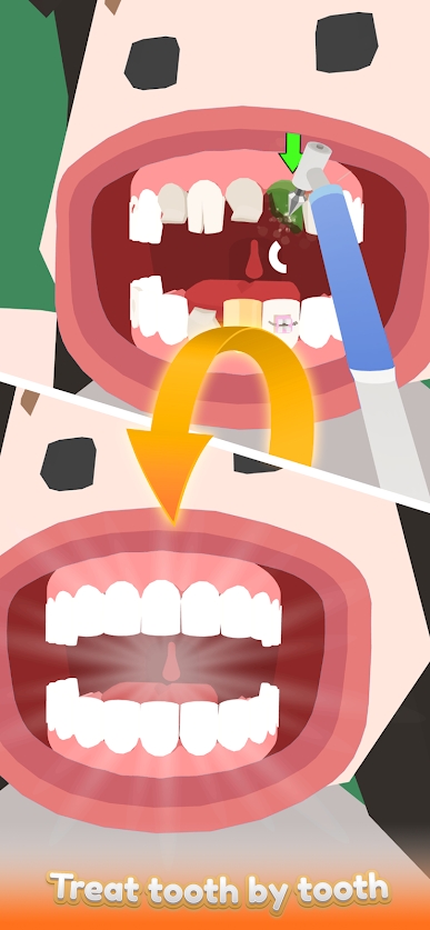 Idle Dentist無限金幣版