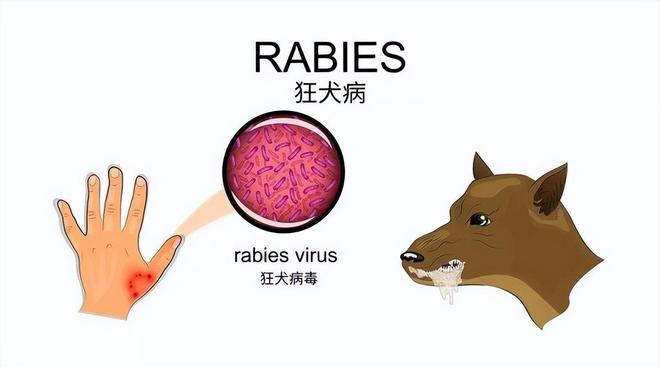 民間常說的恐水癥是以下哪種疾病的別稱