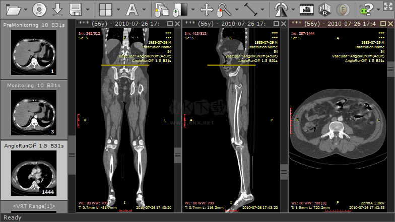 Sante DICOM Viewer Pro（醫(yī)學(xué)DICOM圖像瀏覽器）