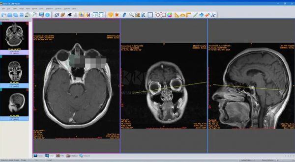 Sante DICOM Viewer Pro（醫(yī)學(xué)DICOM圖像瀏覽器）