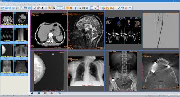 Sante DICOM Viewer Pro（醫(yī)學(xué)DICOM圖像瀏覽器）